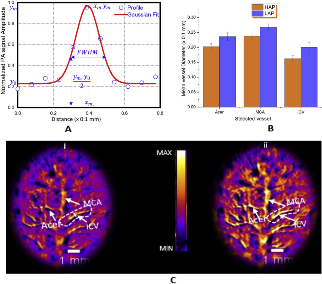 High Alcohol Preferring Mice